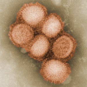 H1N1 © CDC
