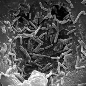 Mycobacterium chelonae
