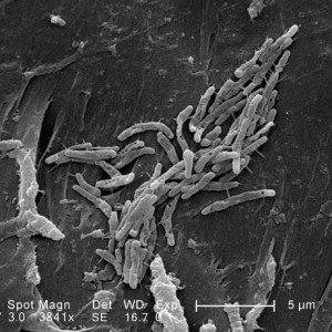 Mycobacterium fortuitum