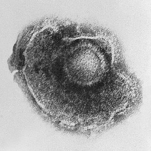 Varicellovirus hhv3